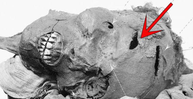 3500 yıllık cinayet! Sır gibi saklanan korkunç gerçek, firavunun tomografisinde ortaya çıktı