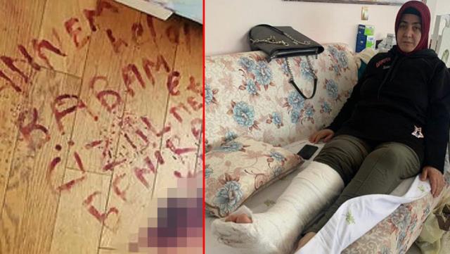Kanıyla yere kendisini kimin vurduğunu yazan kadının kocasından pes dedirten sözler
