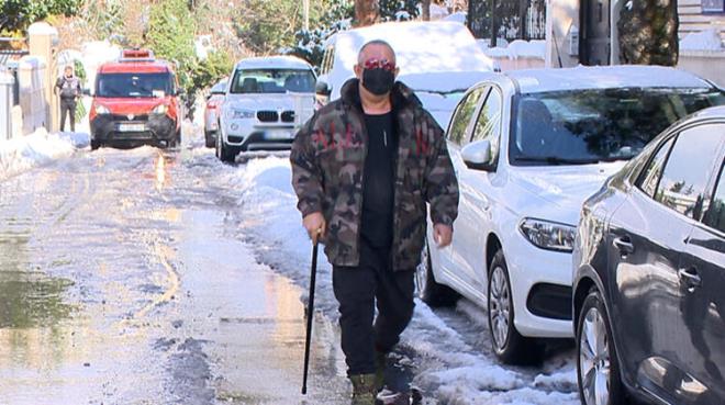 Cem Yılmaz'dan karlı zemine karşı bastonlu önlem