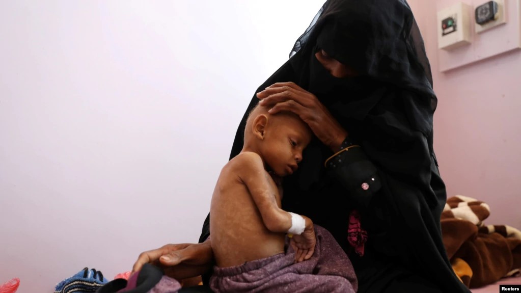 “Yemenliler İçin Kıtlığa Artık Sadece Bir Adım Kaldı”