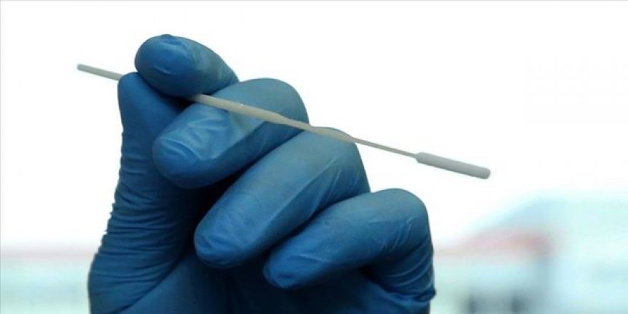 Japonya’dan Çin’e çağrı: Vatandaşlarımıza rektal sürüntü yoluyla Covid-19 testi yapmayın
