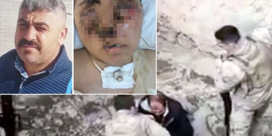 Yüzü tanınmayacak halde! "Bana yardım edin!"