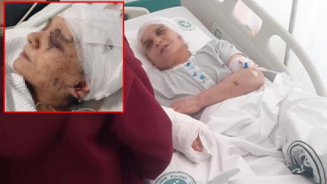 Çalışmasını istemediği eşine satırla saldırdı!