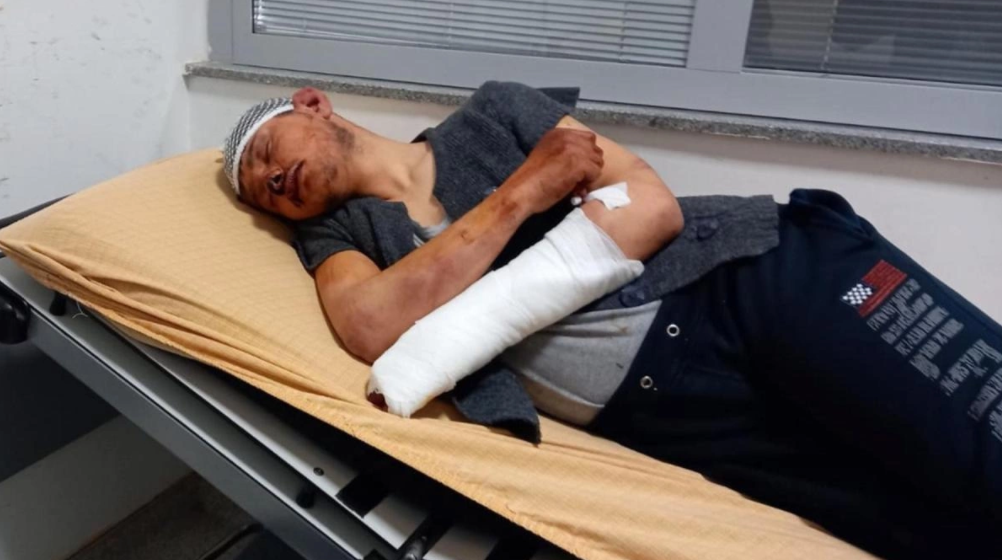 Alacağını isteyen çırağın 5 saat boyunca dövülmesine 1 tutuklama