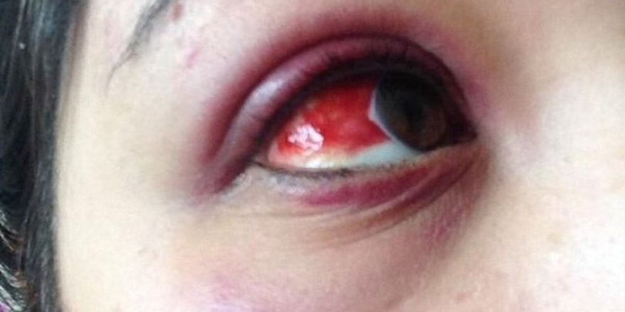 Karabük'te avukattan kadına şiddet