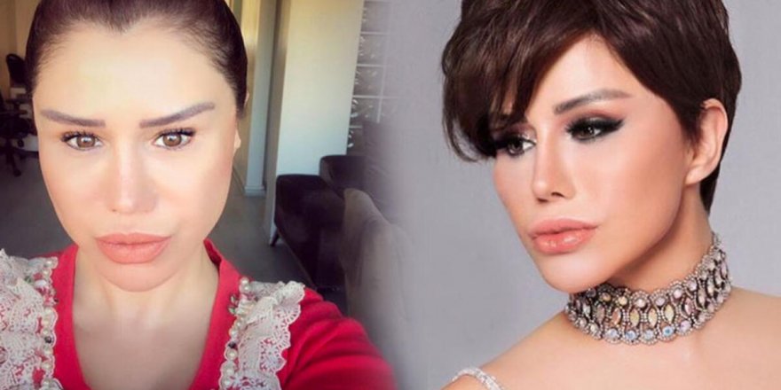 Estetiği abartan Ceylan değişimi ile sosyal medyanın diline düştü!