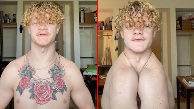 Köprücük kemiği olmayan adamı görenler şaşkınlığa uğradı !