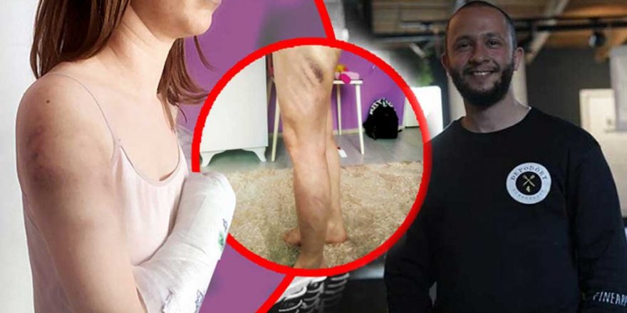 İzmir'de kadına şiddet: 'Fotoğraf beğendiği' için kız arkadaşına beyzbol sopasıyla saldırdı