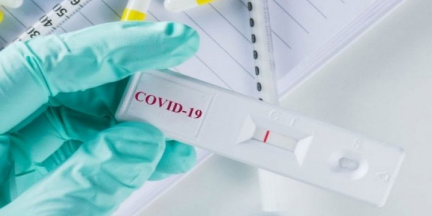 Antikor araştırması: Ev kadınlarını 3 ay, doktorları 9 ay koruyor