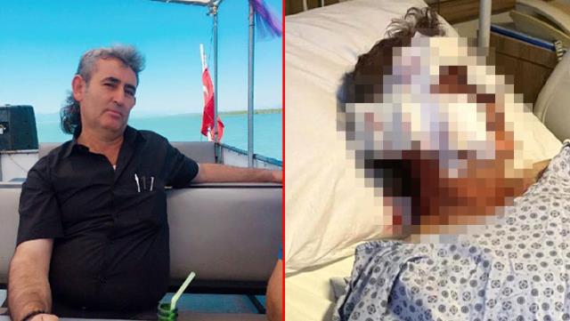 Kafesinden kaçan maymun, otel personelinin yüzünü ısırdı