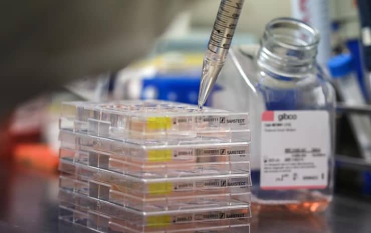 Profesör antikoru düşük çıkanları rahatlattı