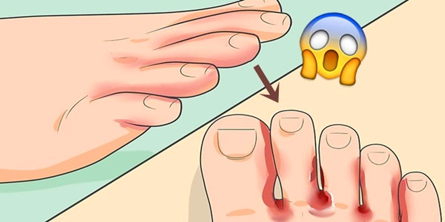 Ayakların Seni Uyarıyor! 11 Önemli İşaret