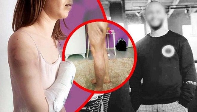 Beyzbol sopasıyla sevgilisini hastanelik eden saldırgana tahliye