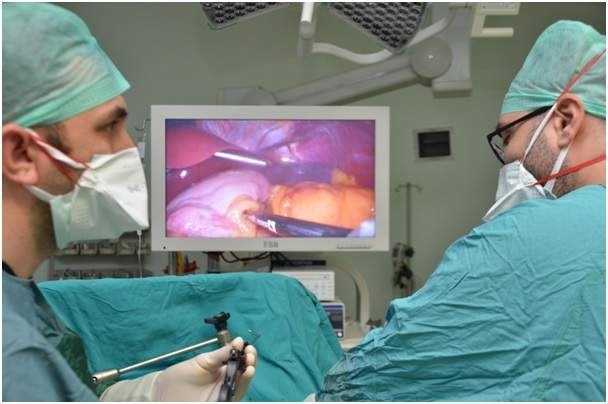 Hitit Üniversitesi’nde ilk kez Laparoskopik tüp mide ameliyatı yapıldı