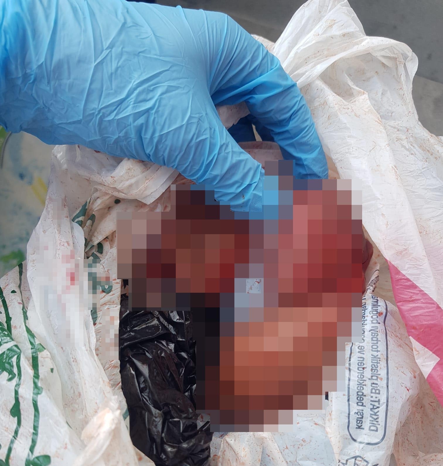 Cadde Ortasında Düşük Yapan Kadın, Bebeğini Çöpe Attı