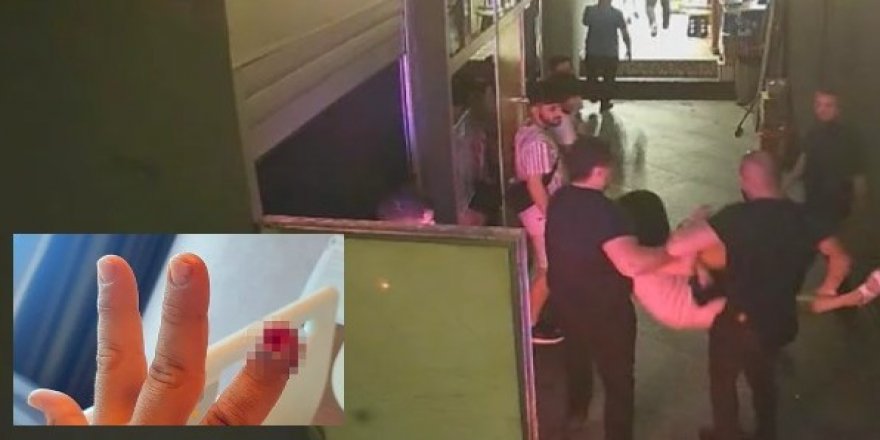 3 Kadın güvenlikçiyi ısırıp kopardı!