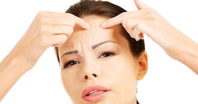 Akne sorununun nedenleri nelerdir?