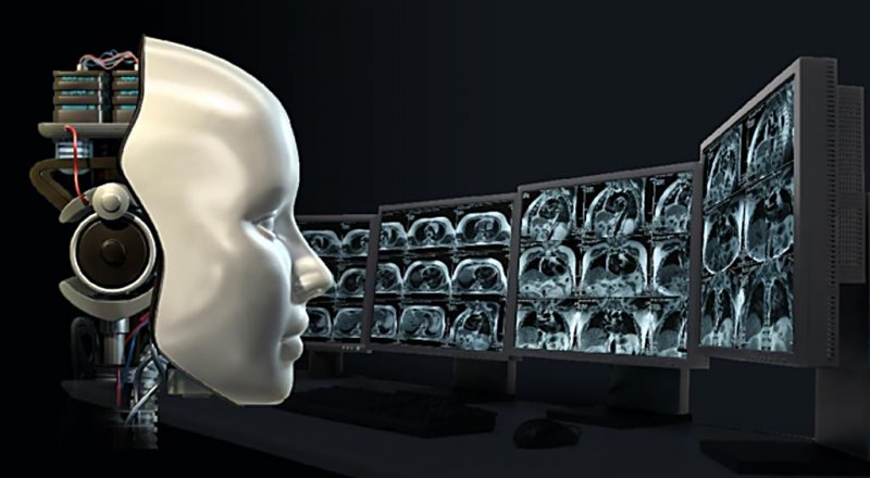 RÖNTGEN FİLMLERİNİ ANALİZ EDEN YAPAY ZEKA, ÇEKİLEN FİLMLERDEN HASTALARIN IRKLARINI DOĞRU TESPİT EDEBİLİYOR