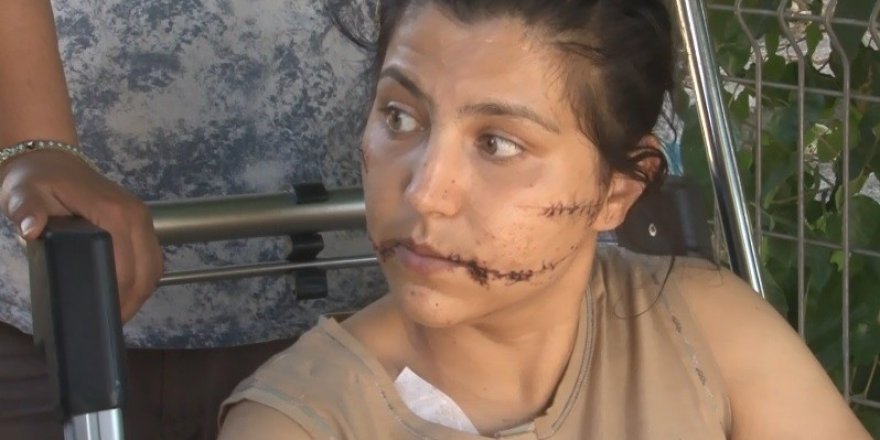 100 Yerinden Bıçaklanan Kadın Yaşadıklarını Anlattı