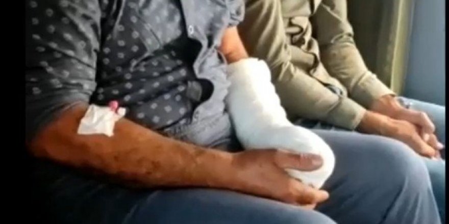 Polis helikopteri parmağı kesilen vatandaş için havalandı