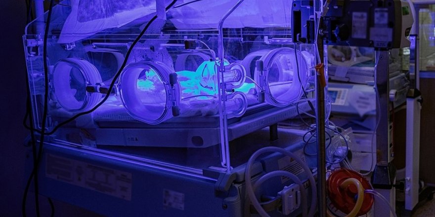 4 Aylık Bebek Kovid-19’dan Hayatını Kaybetti