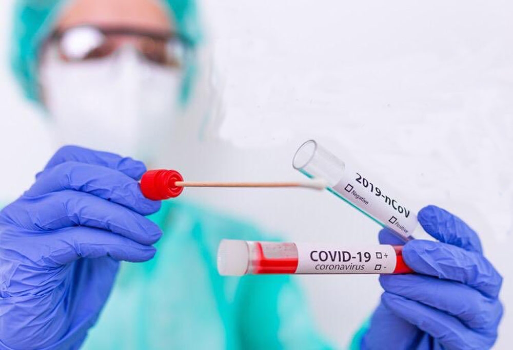 Aşısızlar, PCR Test Laboratuvarlarının Yükünü Artırıyor