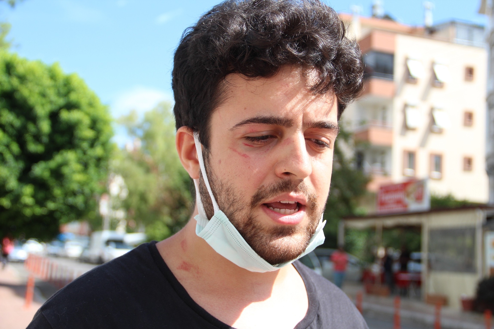 Sokakta köpeklerini gezdiren üniversite öğrencisine saldırı