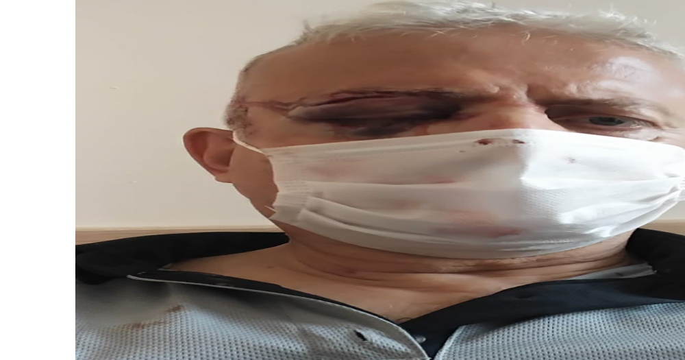 Maske uyarısında bulunduğu şahıs tarafından darp edilen güvenlik görevlisi görme yetisini kaybetti