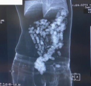 Sindirim sistemlerinde 2 kilonun üzerinde eroin bulunan kuryeler havalimanında yakalandı