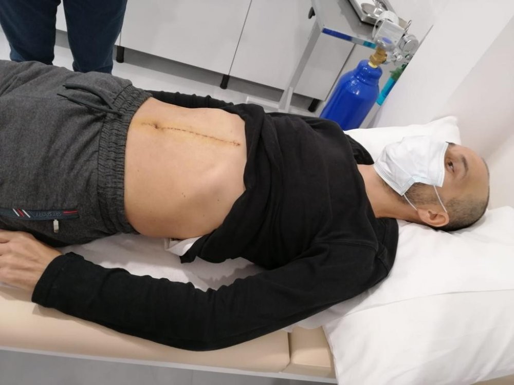 Karnından 2 kiloluk 20 santimetre büyüklüğünde tümör çıktı