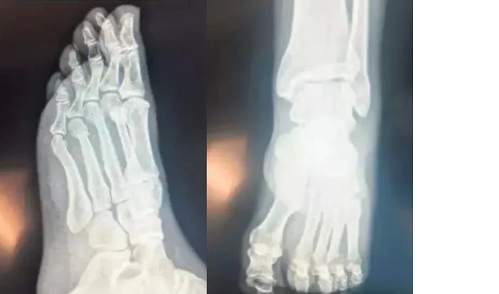 zgur-ozel-rontgen-filmlerini-paylasarak-gercegi-acikladi1.webp